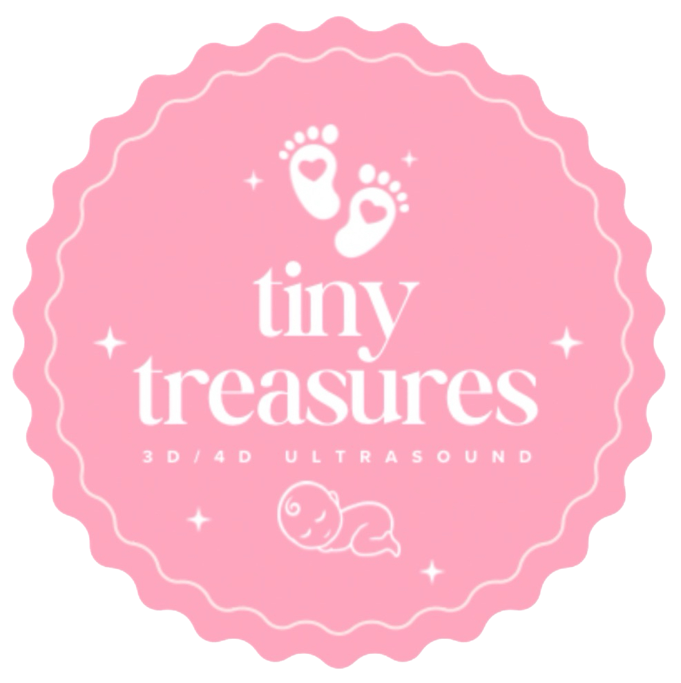 tiny-treasures-logo.png