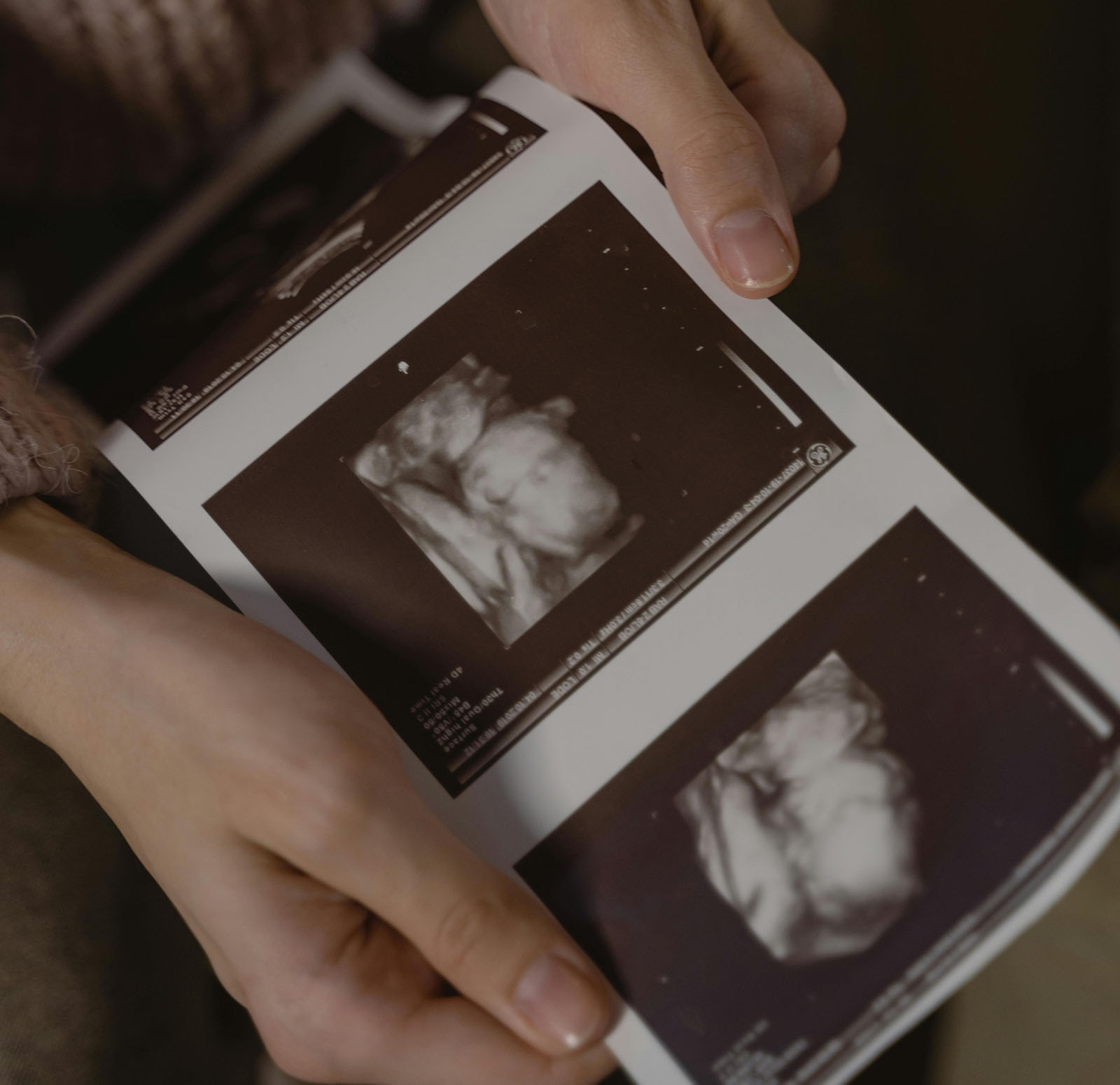 16 weeks 3D ultrasound