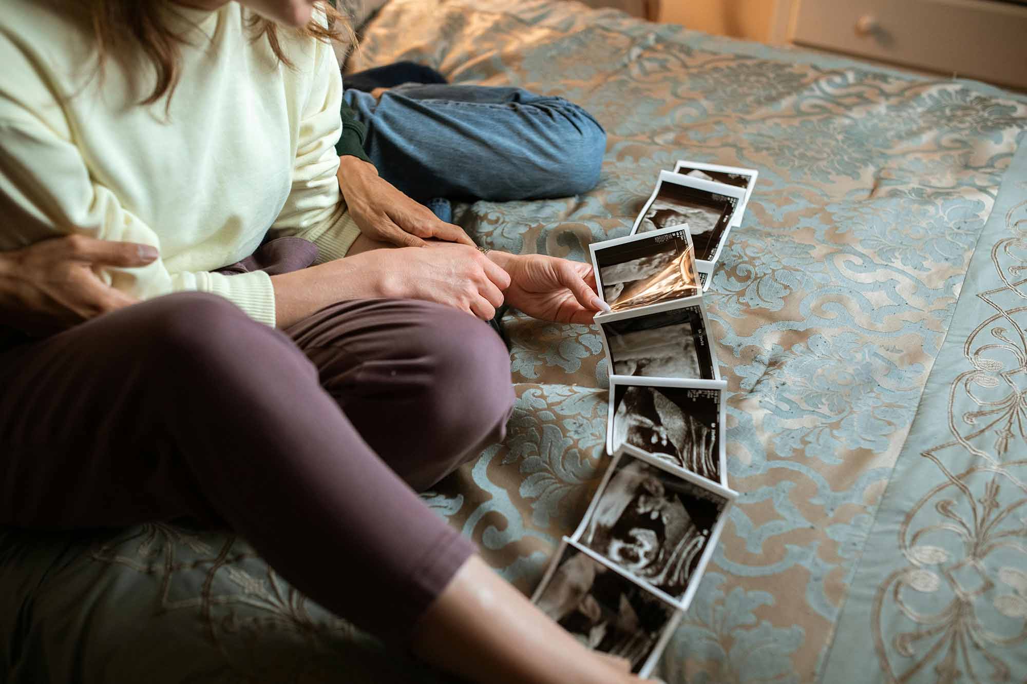 13 week 3d ultrasound