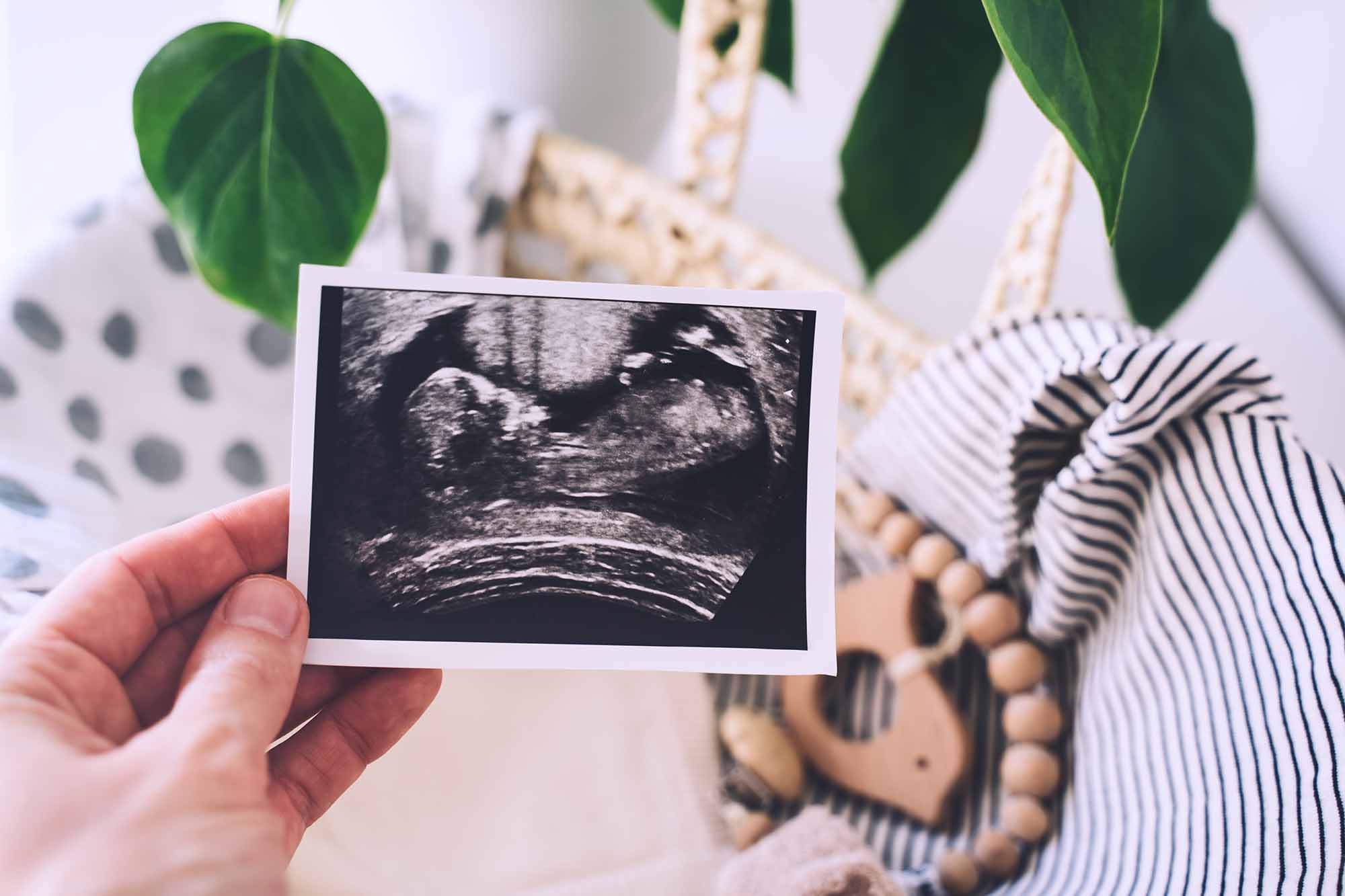 3d Ultrasound Morristown NJ - Ultrasound Photo with wooden toys